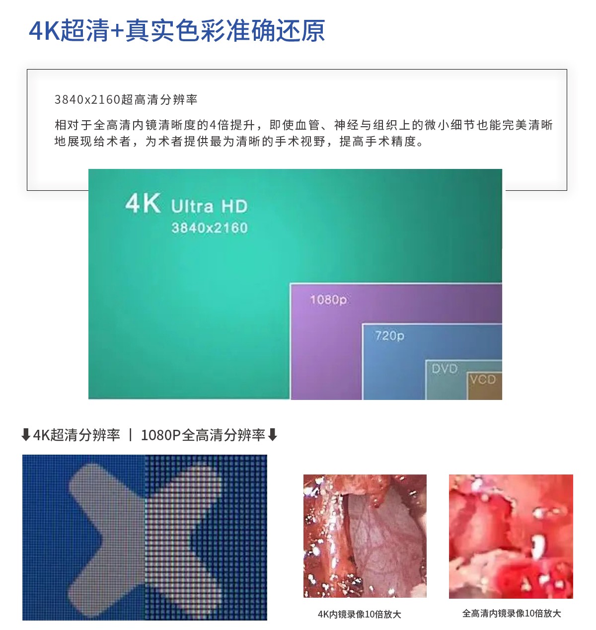 【4K醫用內窺鏡攝像系統】您的第一臺“4K”找到了嗎？