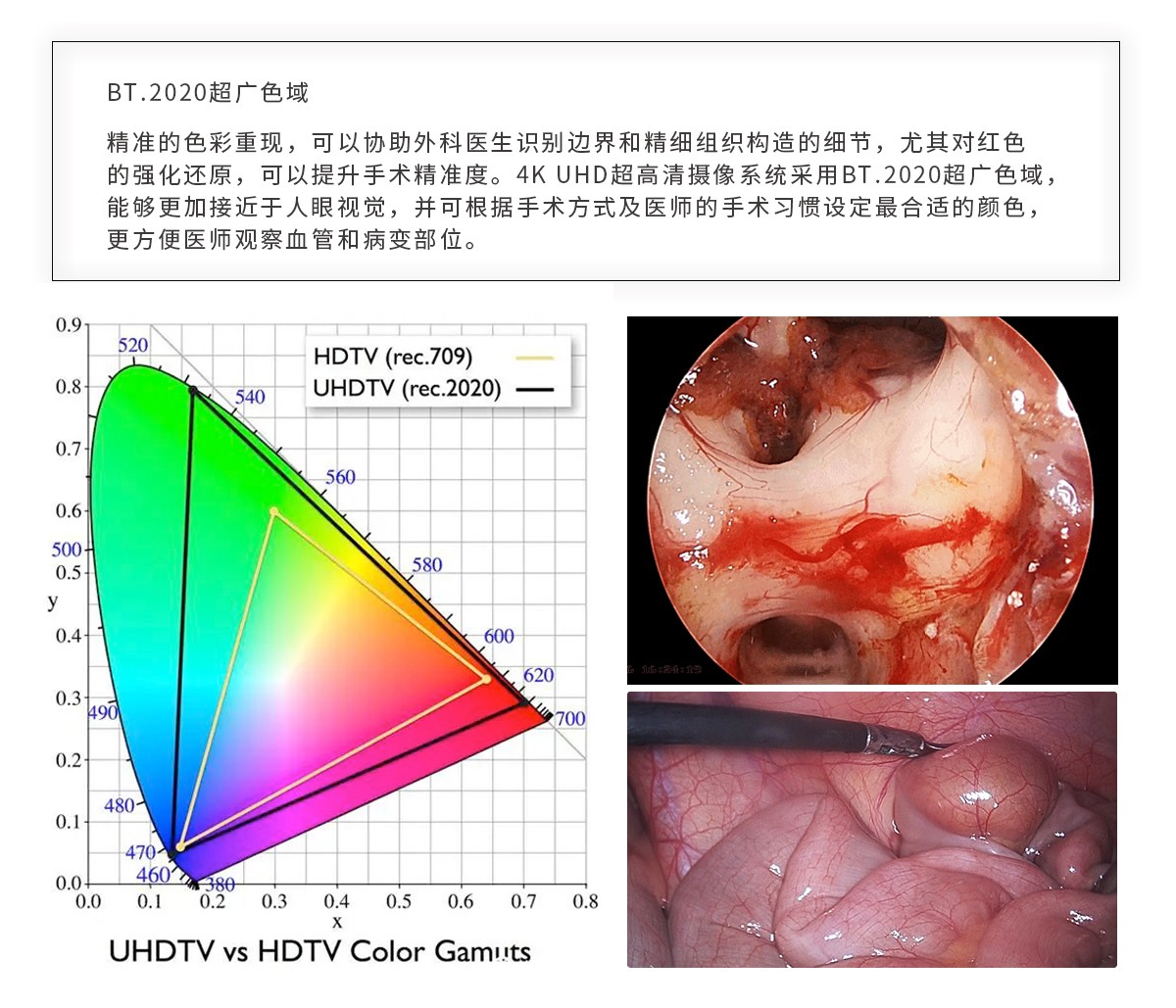 【4K醫用內窺鏡攝像系統】您的第一臺“4K”找到了嗎？