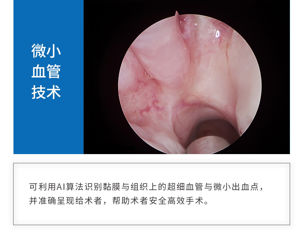 【4K醫用內窺鏡攝像系統】您的第一臺“4K”找到了嗎？